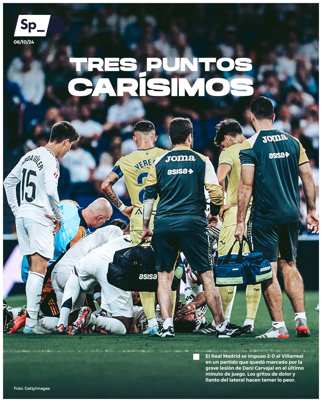 Tres puntos carísimos