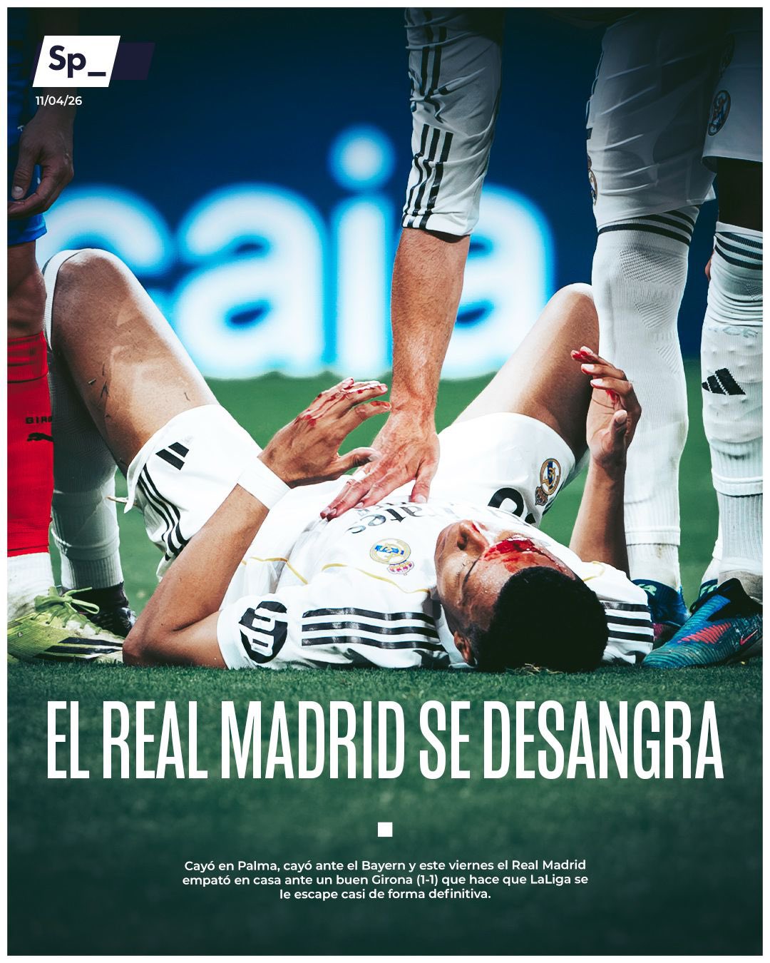 El Real Madrid se desangra